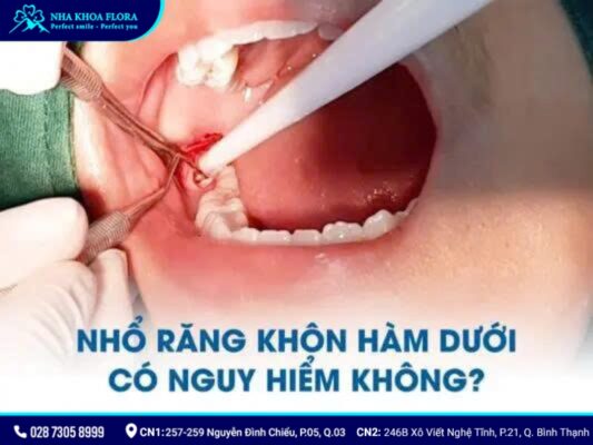 nhổ răng khôn có nguy hiểm không - ảnh 4 nhổ răng khôn có nguy hiểm không - ảnh 4