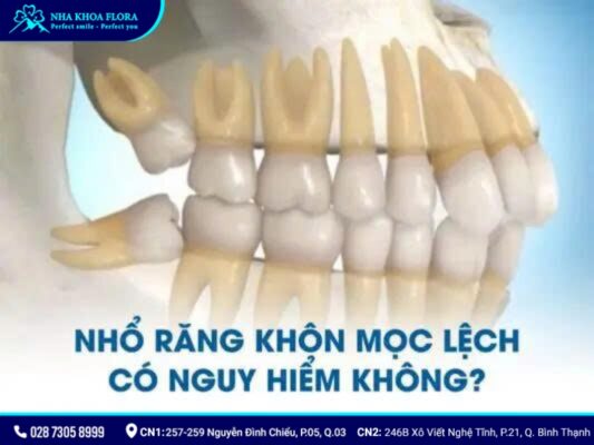 nhổ răng khôn có nguy hiểm không - ảnh 5 nhổ răng khôn có nguy hiểm không - ảnh 5