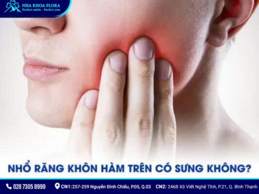 nhổ răng khôn hàm trên - ảnh 3 nhổ răng khôn hàm trên - ảnh 3