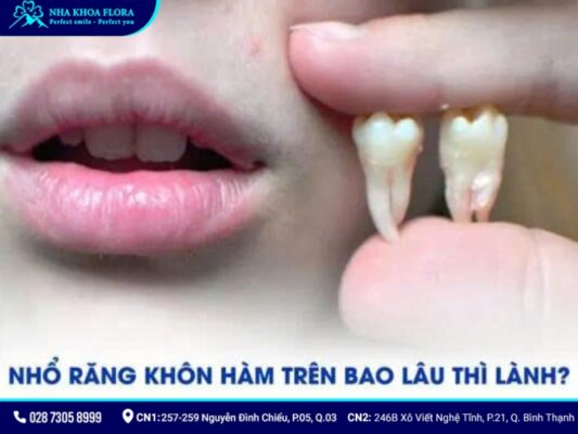 nhổ răng khôn hàm trên - ảnh 5 nhổ răng khôn hàm trên - ảnh 5
