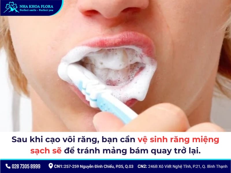 cạo vôi răng