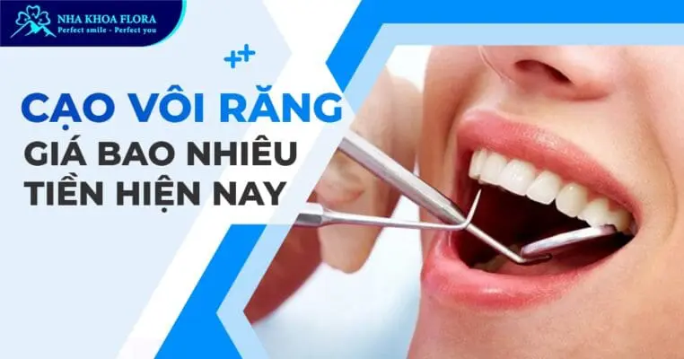 Cạo vôi răng giá bao nhiêu tiền tại Nha khoa Flora? 2