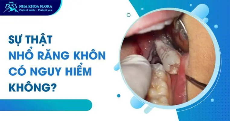 Nhổ răng khôn có nguy hiểm không? có ảnh hưởng gì không? 5