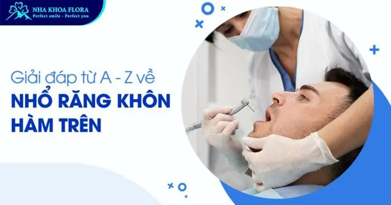 Nhổ răng khôn hàm trên có nên không? Giá bao nhiêu tiền? 4