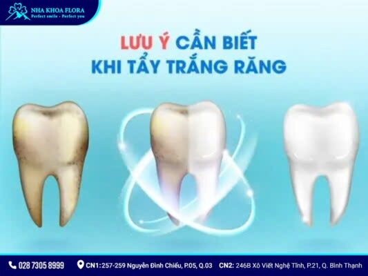 tẩy trắng răng có hại không - ảnh 6