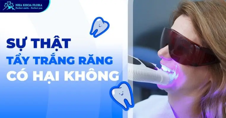 Tẩy trắng răng có hại không? Có làm hỏng men răng? 2