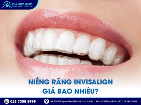 Giá niềng răng Invisalign - ảnh 1