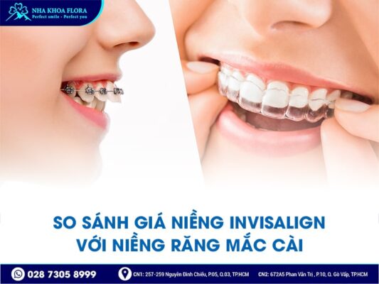 Giá niềng răng Invisalign - ảnh 2