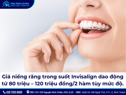 giá niềng răng trong suốt - ảnh 1 giá niềng răng trong suốt - ảnh 1