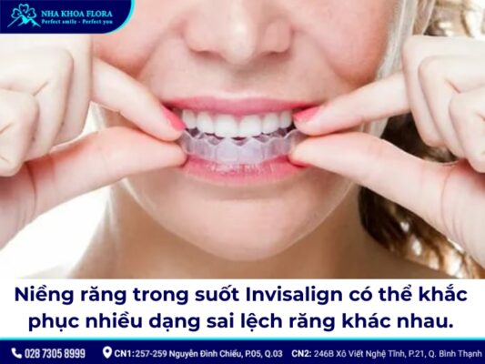 giá niềng răng trong suốt - ảnh 3 giá niềng răng trong suốt - ảnh 3