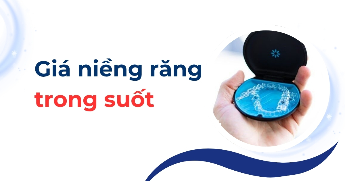 Giá niềng răng trong suốt bao nhiêu? Bảng giá mới nhất 2025