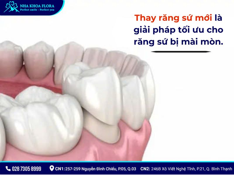 răng sứ có bị mòn không