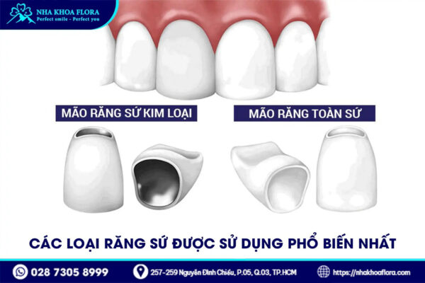 Bảng Giá 1