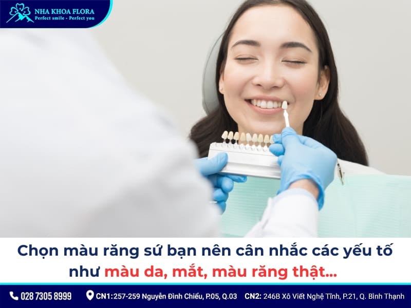 bảng màu răng sứ