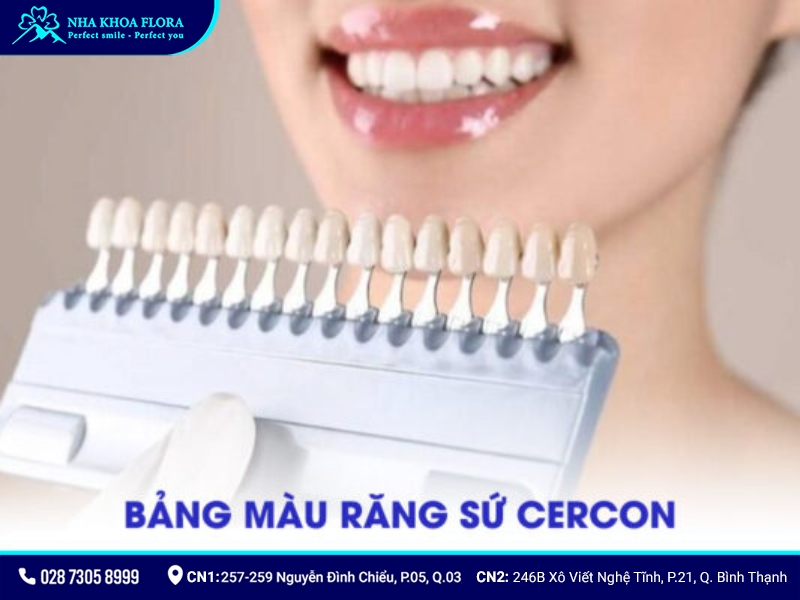 bảng màu răng sứ
