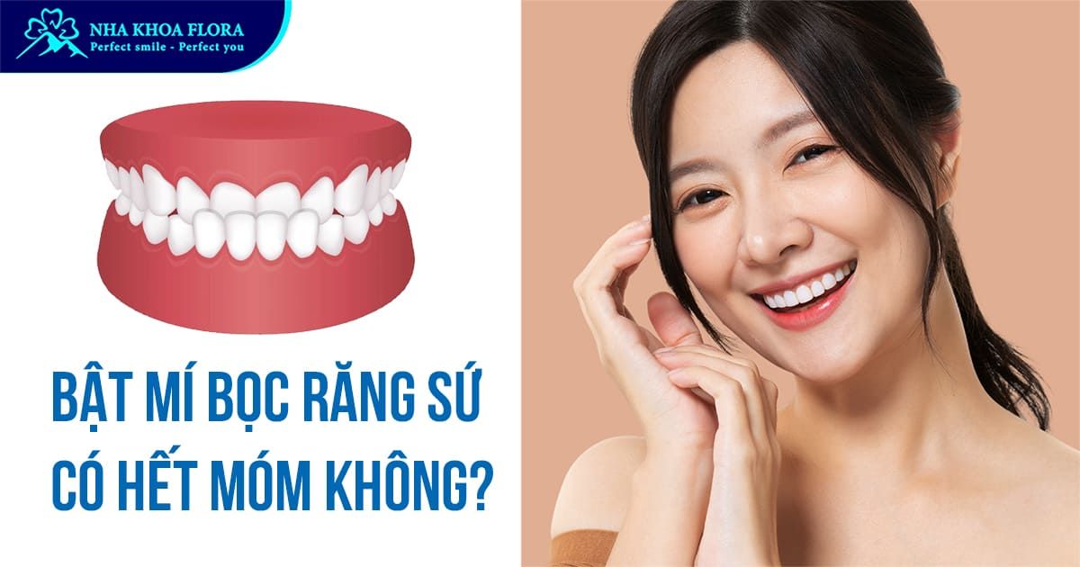 Bọc răng sứ có hết móm không? Các lưu ý quan trọng cần biết