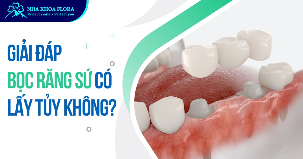 Bọc răng sứ có lấy tủy không? Khi nào cần lấy tủy bọc sứ?