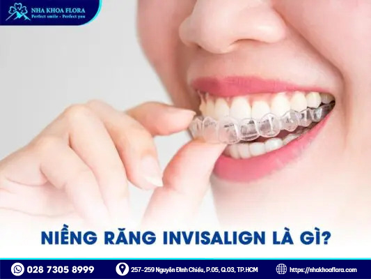 Niềng răng trong suốt Invisalign 1