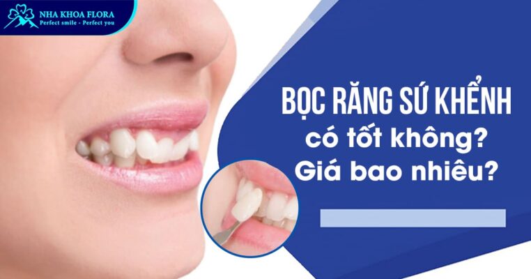 bọc răng sứ khểnh
