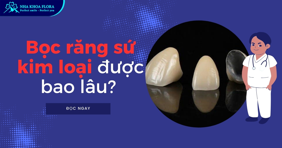 Bọc răng sứ kim loại được bao lâu? Mẹo kéo dài tuổi thọ răng