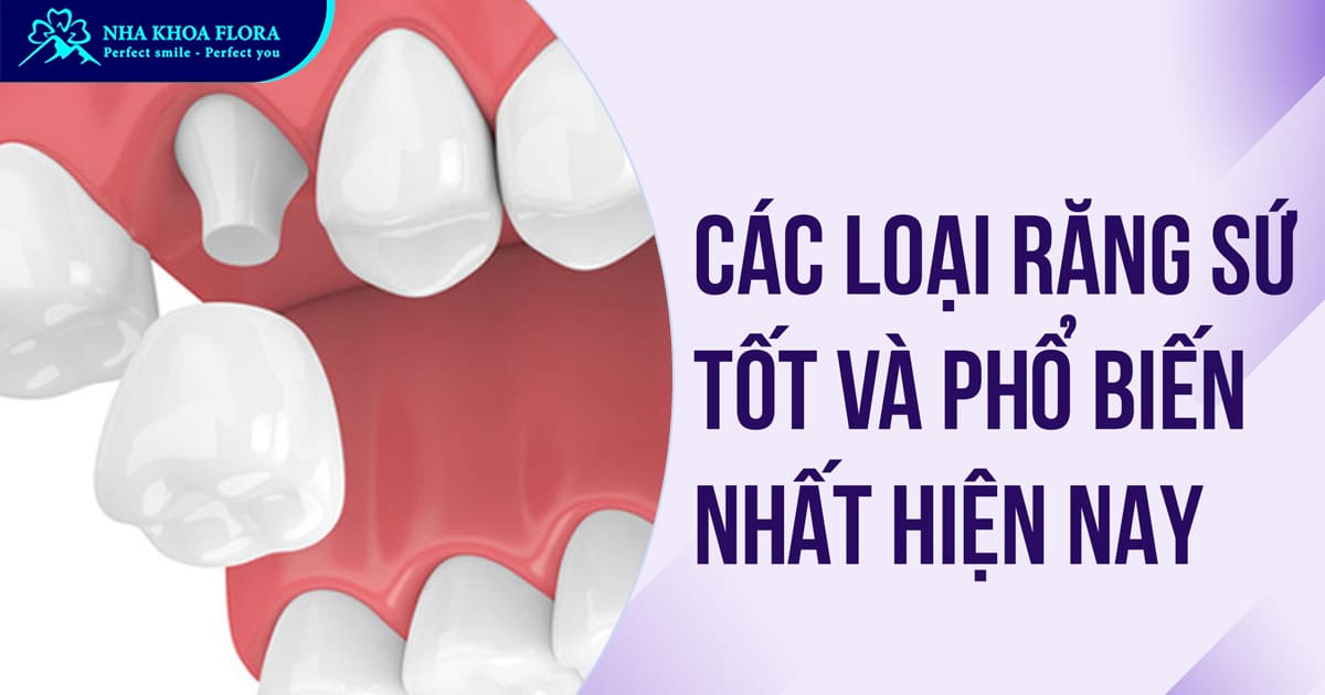 Các loại răng sứ được chuyên gia đánh giá tốt nhất hiện nay