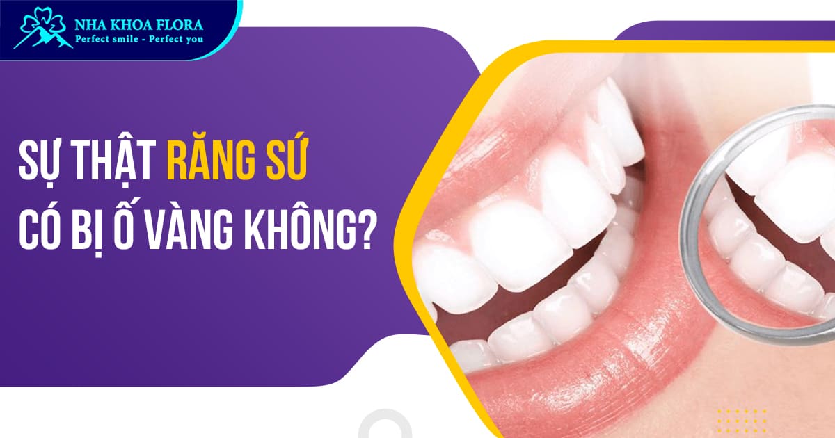 Răng sứ có bị ố vàng không? Cách khắc phục răng sứ xuống màu