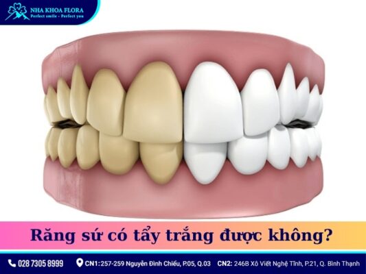 răng sứ có tẩy trắng được không - ảnh 1