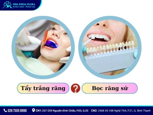 răng sứ có tẩy trắng được không - ảnh 5