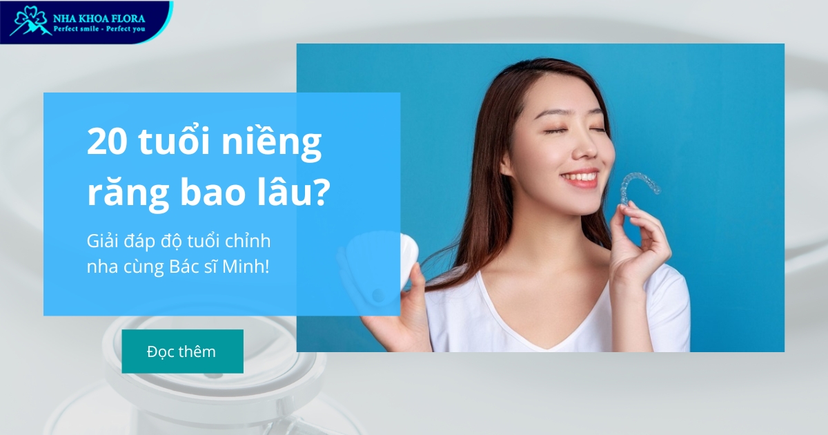 20 tuổi niềng răng bao lâu? Giải đáp độ tuổi chỉnh nha