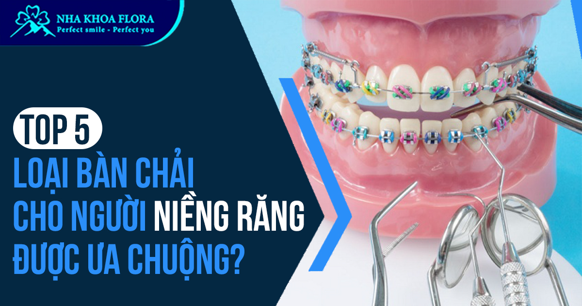 Top 5 loại bàn chải cho người niềng răng được ưa chuộng