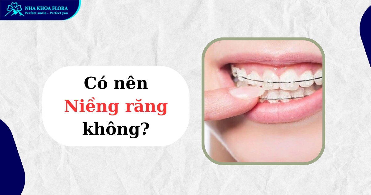 Có nên niềng răng không? Khi nào nên & không nên thực hiện?