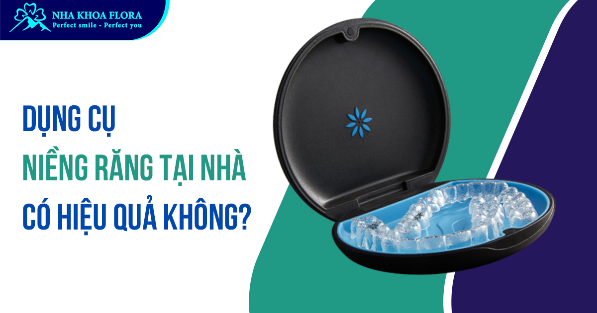 Niềng răng tại nhà là gì? Có an toàn và hiệu quả không?