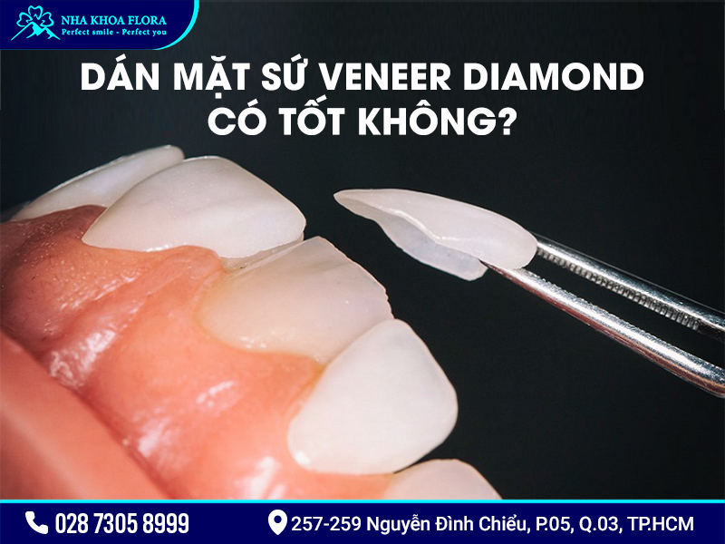 Mặt Dán Sứ Diamond Có Tốt Không? Giá Bao Nhiêu?