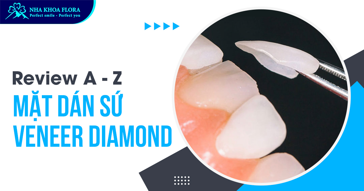 Mặt dán sứ Diamond có tốt không? Giá bao nhiêu?