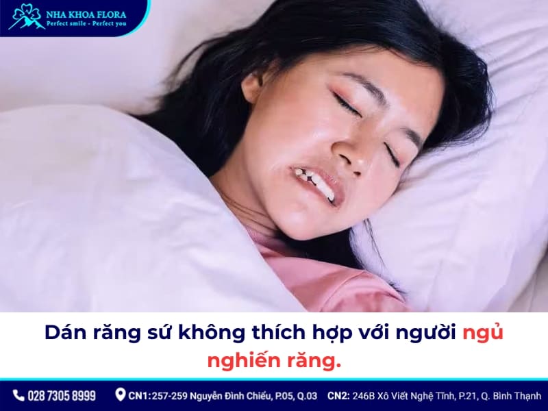 nhược điểm của dán răng sứ