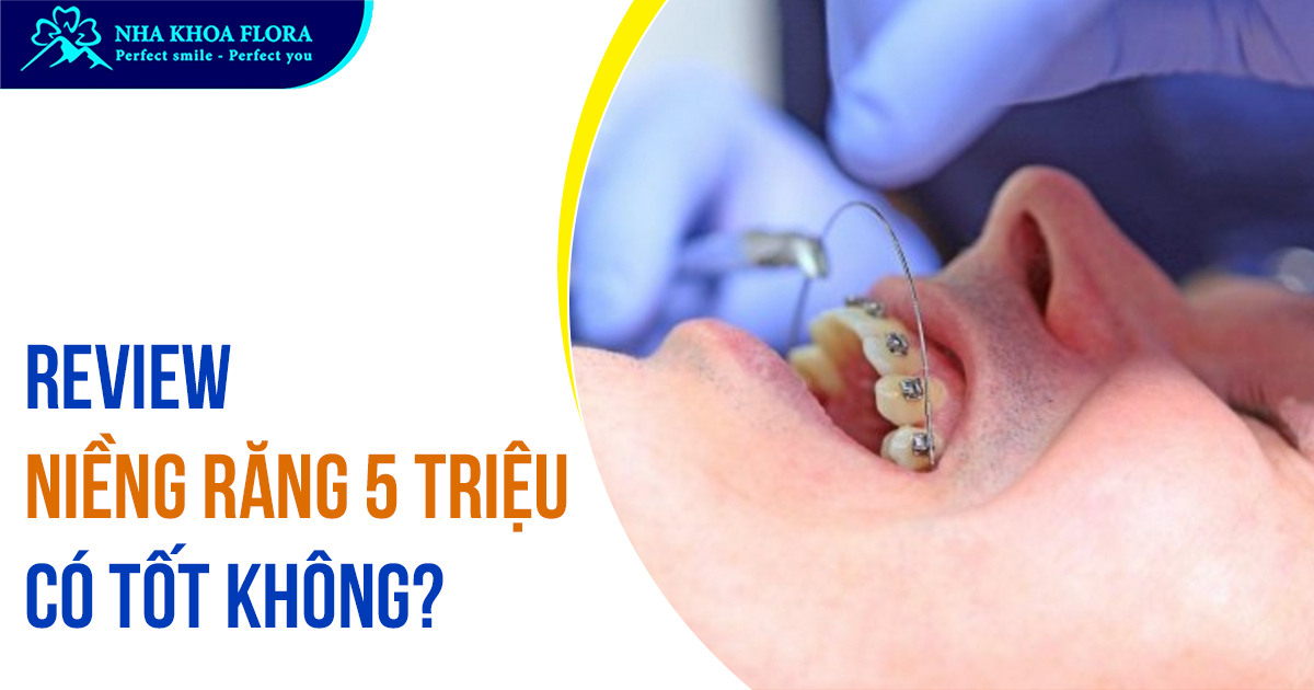 Sự thật niềng răng 5 triệu có an toàn và hiệu quả không?