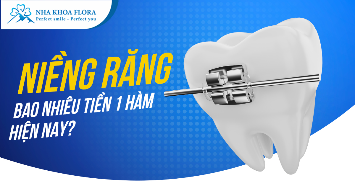 Niềng răng bao nhiêu tiền 1 hàm? Chi phí chỉnh nha 1 hàm