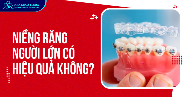niềng răng người lớn