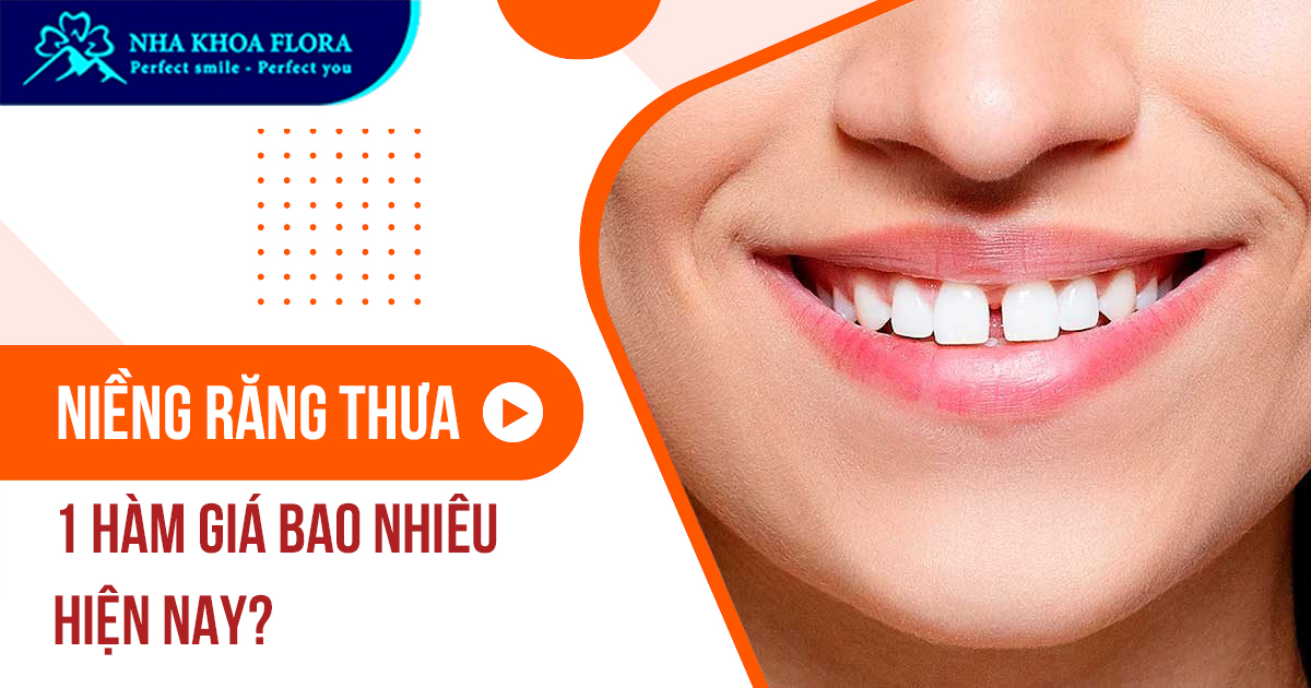 Niềng răng thưa 1 hàm giá bao nhiêu hiện nay?