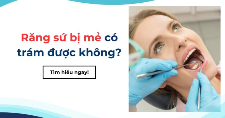 răng sứ bị mẻ có trám được không