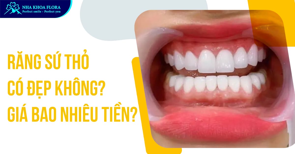 Răng sứ thỏ có đẹp không? Cách làm răng sứ thỏ đẹp tự nhiên