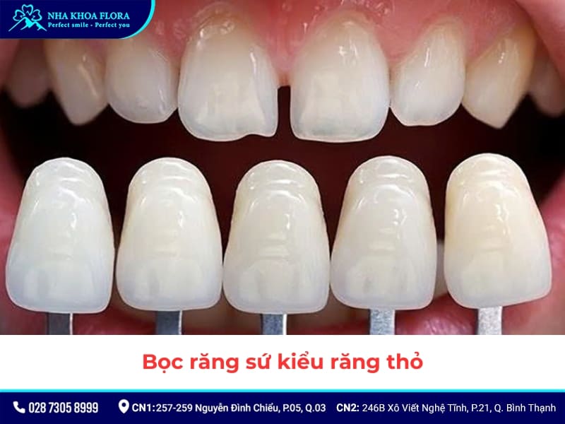 răng sứ thỏ