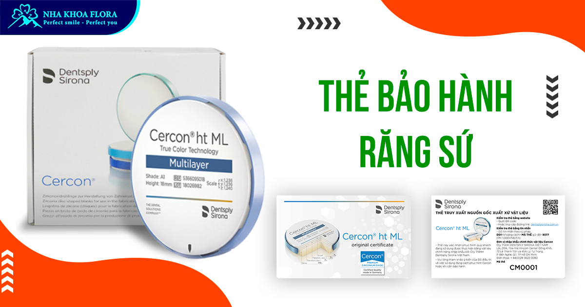 Thẻ bảo hành răng sứ: Lợi ích & Điều kiện bạn nên biết