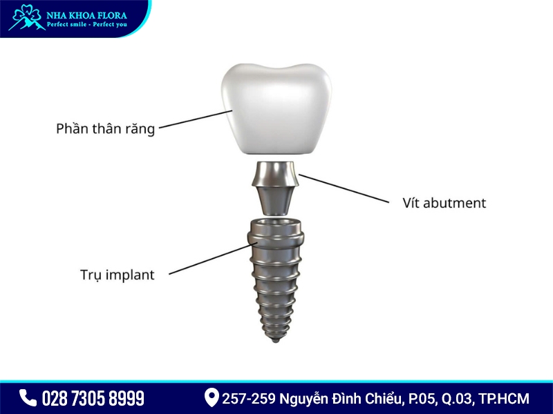 abutment