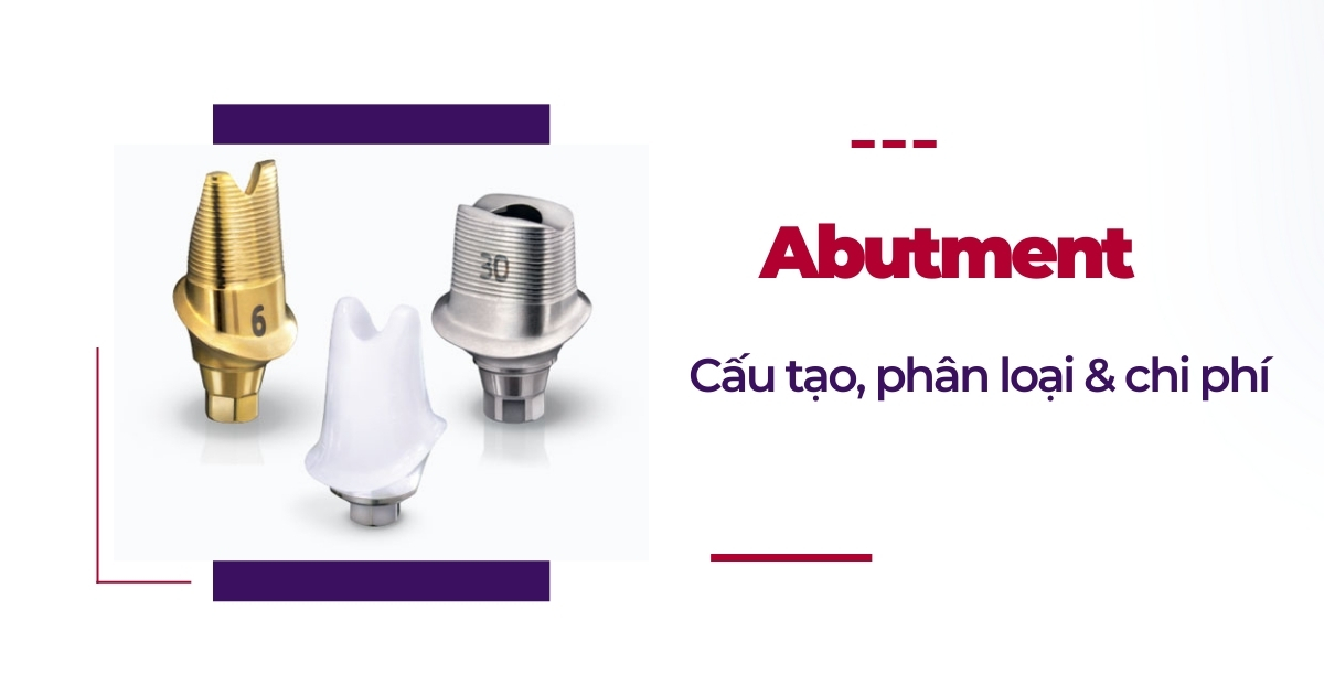 Abutment: Cấu tạo, phân loại và chi phí bao nhiêu tiền?