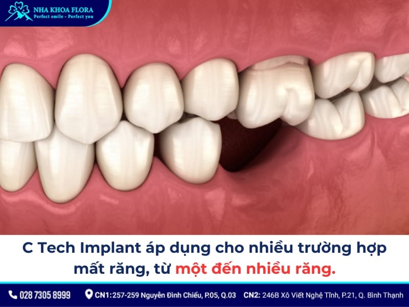 c tech implants