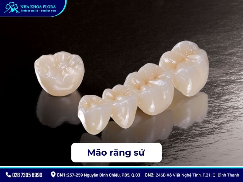 cấu tạo implant