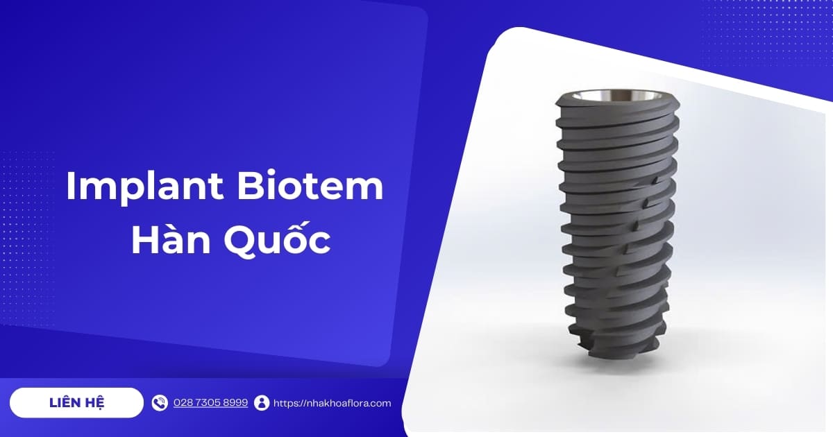 Implant Biotem của nước nào? Có tốt không? Giá bao nhiêu?