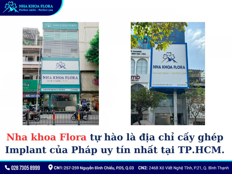 implant của pháp