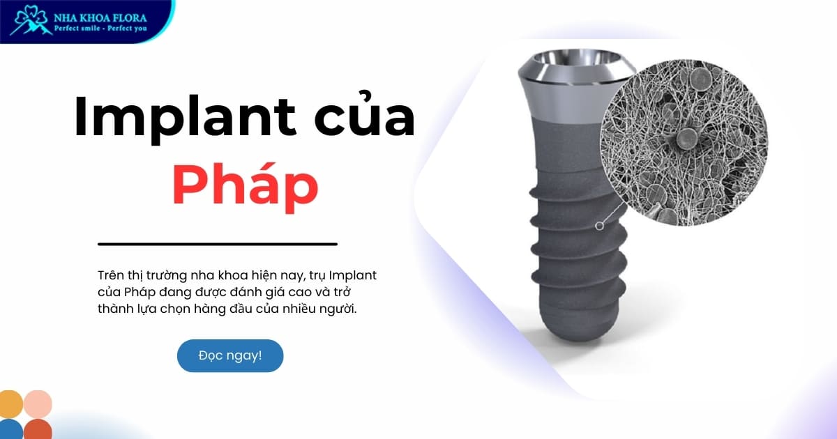 Trụ Implant của Pháp có tốt hay không? Giá bao nhiêu tiền?